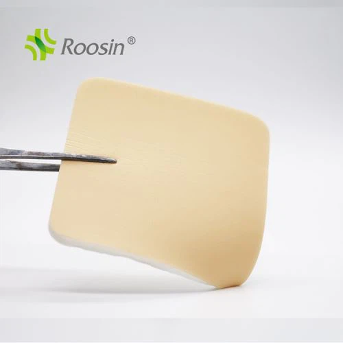 폴리우레탄 폼 드레싱